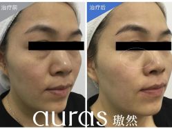 -AURAS璈然科技护肤中心