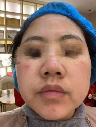 体验后-成都艾特他整形外科医院