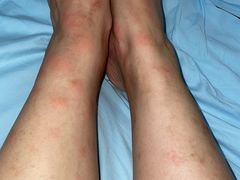 -五七小李子油焖大虾(总店)