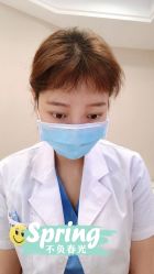 体验后-大麦微针植发全国连锁