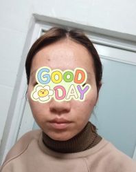 -苗方清颜痘肌研究所