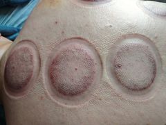 -艾通康缘艾灸.疼痛.睡眠养生馆(凤凰城店)