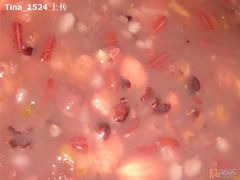 八宝局部-宏状元现熬粥·京味菜(三里河店)