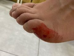 -郑远元专业修脚房·按摩·肉刺·灰指甲(建邺水西门店)