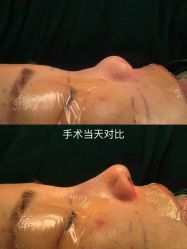 -北京米扬丽格医疗美容·联合丽格鼻整形中心