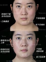 点击看大图 -Yestar重庆艺星医疗美容医院