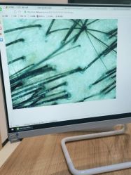 -雍禾植发全国连锁