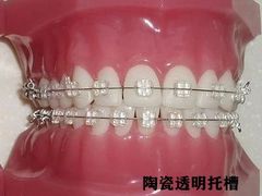 -团圆口腔·种植中心(锦江院区)