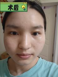 -素美医疗美容·西南眼鼻整形·修复基地