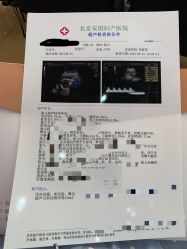 -北京安琪