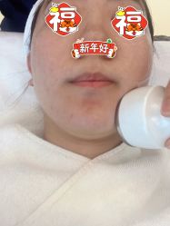 体验后-恒妍医美·韩国定制抗衰中心
