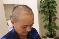 -大麦微针植发丨全国连锁