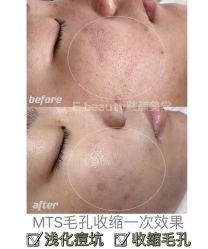 -E.beauty驻颜·痘敏肌调理中心