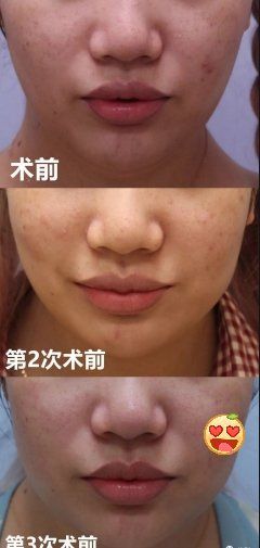 -成都西区医院整形美容