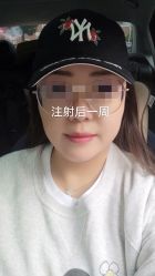 -More摩尔医美の注射线雕光电中心