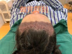 -郡艺医疗美容·微整·眼鼻吸脂