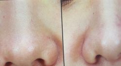 -苑苑vbeauty科技美容SPA