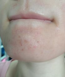 -素妍印象Ekrin Medi Clinic