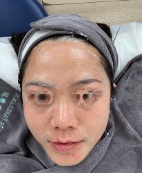 体验后-原力医疗美容