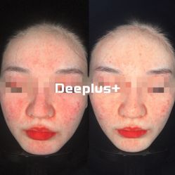 -Deeplus+韩国皮肤管理한국피부관리·C:Lab肌肤实验室