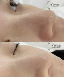 -SKIN79皮肤管理中心
