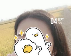 -大麦微针植发全国连锁