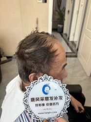 -唐风采假发补发定制