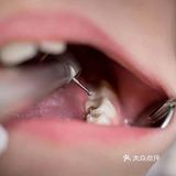 废用侧小 咀嚼功能受到影响后,食欲下降