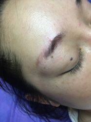 点击看大图 -西施无菌半永久纹绣眉眼影唇轻增发纹发际线