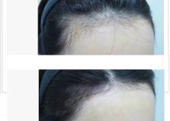 -UP&UP·半永久眉毛眼线机器野生眉