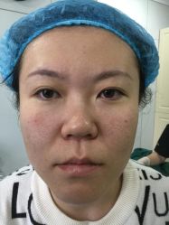-天津健丽·去眼袋医疗美容机构