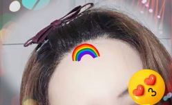 -大麦微针植发全国连锁