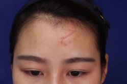 -正璞医疗美容·皮肤修复·微整注射