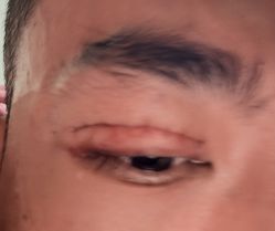 点击看大图 -泉州欧菲医疗美容