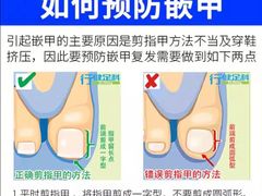 -朋朋修脚·灰指甲·甲沟炎·跖疣(人民路店)