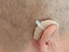 -安湃声助听器(密云店)