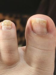 -杨红水晶延长美甲美睫