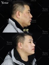 -Yestar艺星医疗美容医院