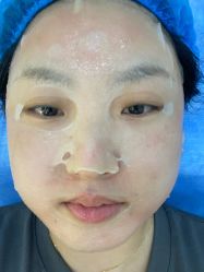 体验后-禾慕时光医疗美容