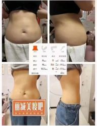 -丽减美瘦吧·减肥瘦身