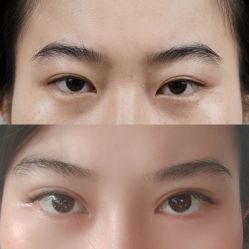 -素美医疗美容·西南眼鼻整形·修复基地