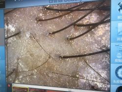 -雍禾植发全国连锁