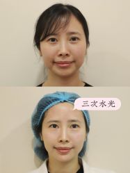 -上海时光整形外科医院