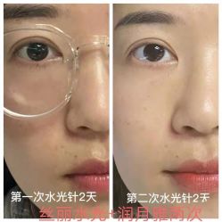 -上海漾颜医疗美容