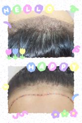 -熙朵美学植发·连锁品牌