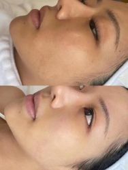 -LUNA皮相美·骨相美高级美感