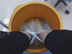 -派恩宜灰指甲鸡眼嵌甲手足癣