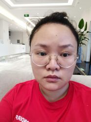 体验前-上海首尔丽格医疗美容医院