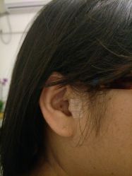 -肥三针腧穴瘦身馆