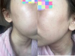 体验后-JS医疗美容